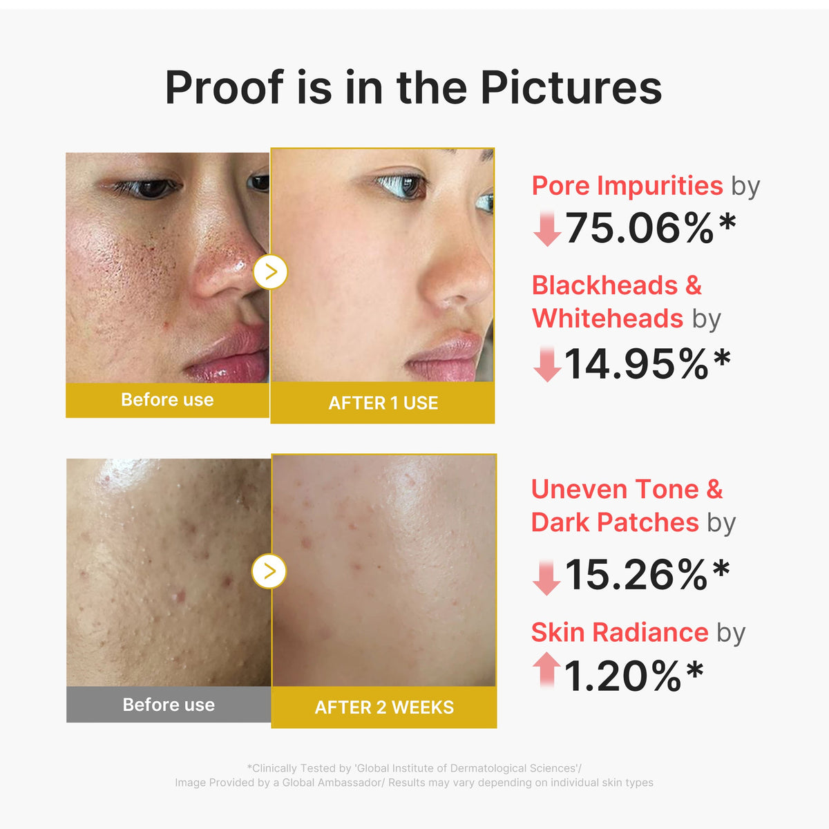 Medicube Kojic Acid Turmeric Peel Shot 80ml – exfoliation douce BHA LHA PHA